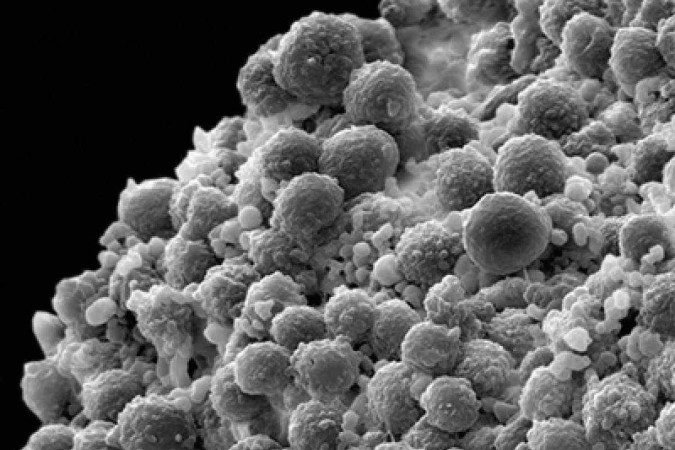 Aglomerado de células de câncer de próstata: tumor é um dos mais incidentes no Brasil e no mundo - (crédito: Biblioteca de Imagens da Célula) Aglomerado de células de câncer de próstata: tumor é um dos mais incidentes no Brasil e no mundo - (crédito: Biblioteca de Imagens da Célula)