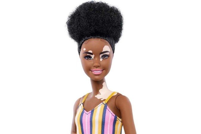 Barbie representa meninas com virtiligo - (crédito: Amazon/Reprodução) Barbie representa meninas com virtiligo - (crédito: Amazon/Reprodução)