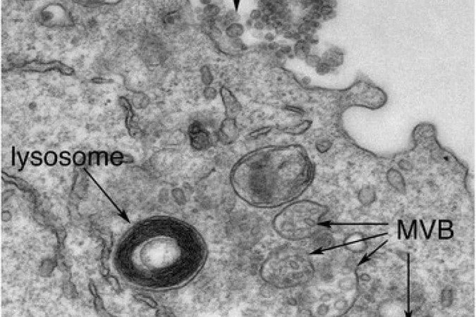 Vírus epstein barr infectando uma célula 