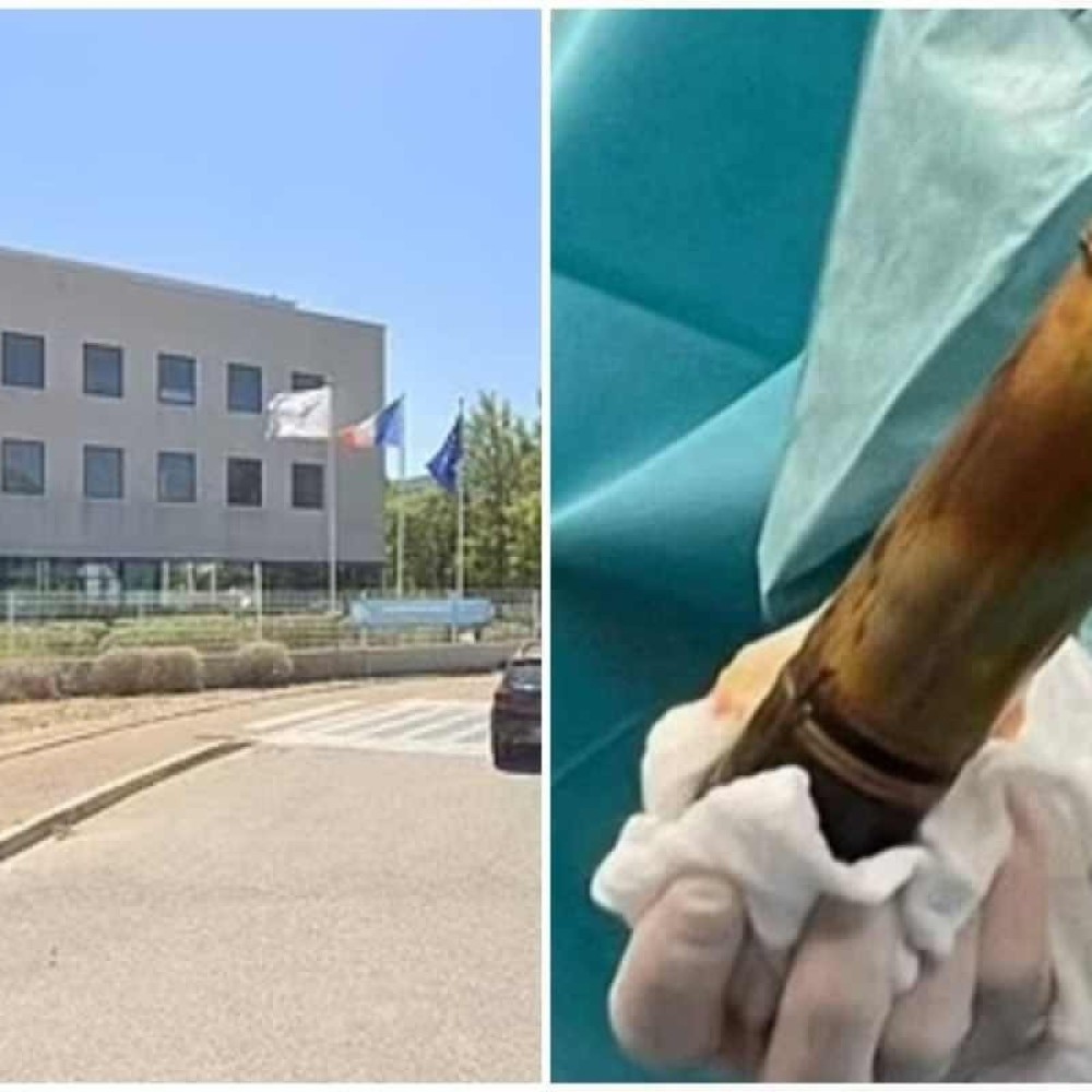 Homem dá entrada em hospital com bomba no ânus e local tem de ser esvaziado