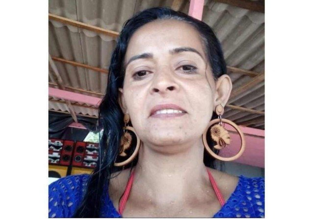 Odineia ficou com o rosto completamente desfigurado - (crédito: Material cedido ao Correio) Odineia ficou com o rosto completamente desfigurado - (crédito: Material cedido ao Correio)