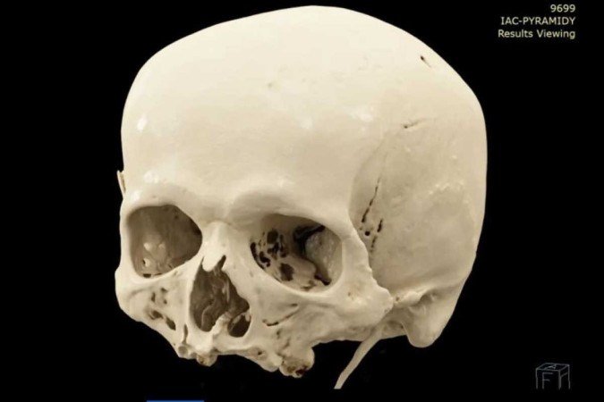  (crédito: Evy Drozdov/Masaryk University)