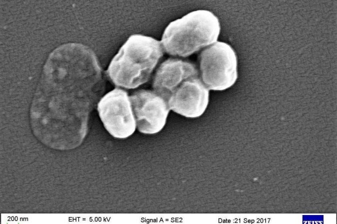  (crédito: CeNSE, IISc, Bangalore/Reprodução )