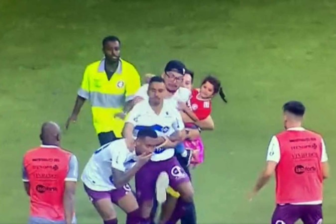 FOTO: Jogador do Caxias fica com nariz 'deformado' após confusão em jogo  contra o Inter