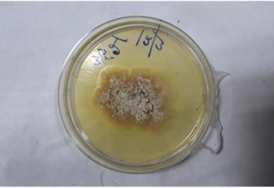 Reprodução/Medical Mycology Case Reports