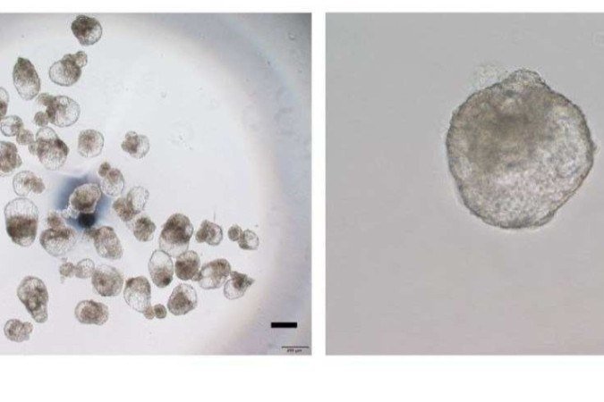 Blastoides preparados para transferência