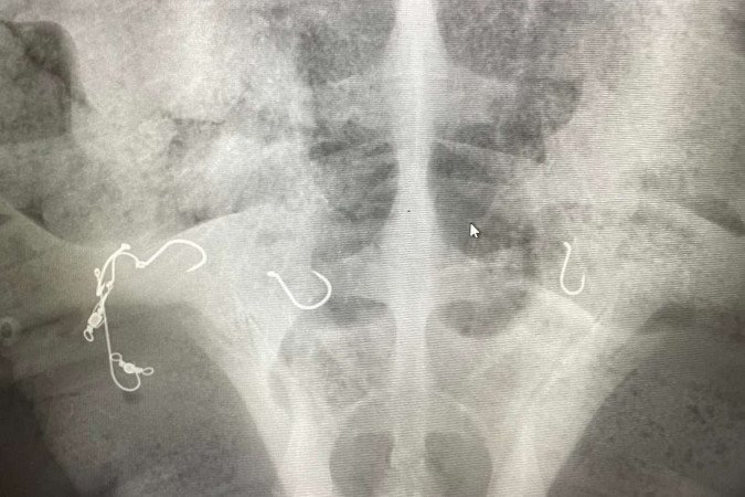 Os raios-x fizeram a revelação de sete ganchos no animal -  (crédito: Reprodução/ Facebook/ Taronga Zoo Sydney)