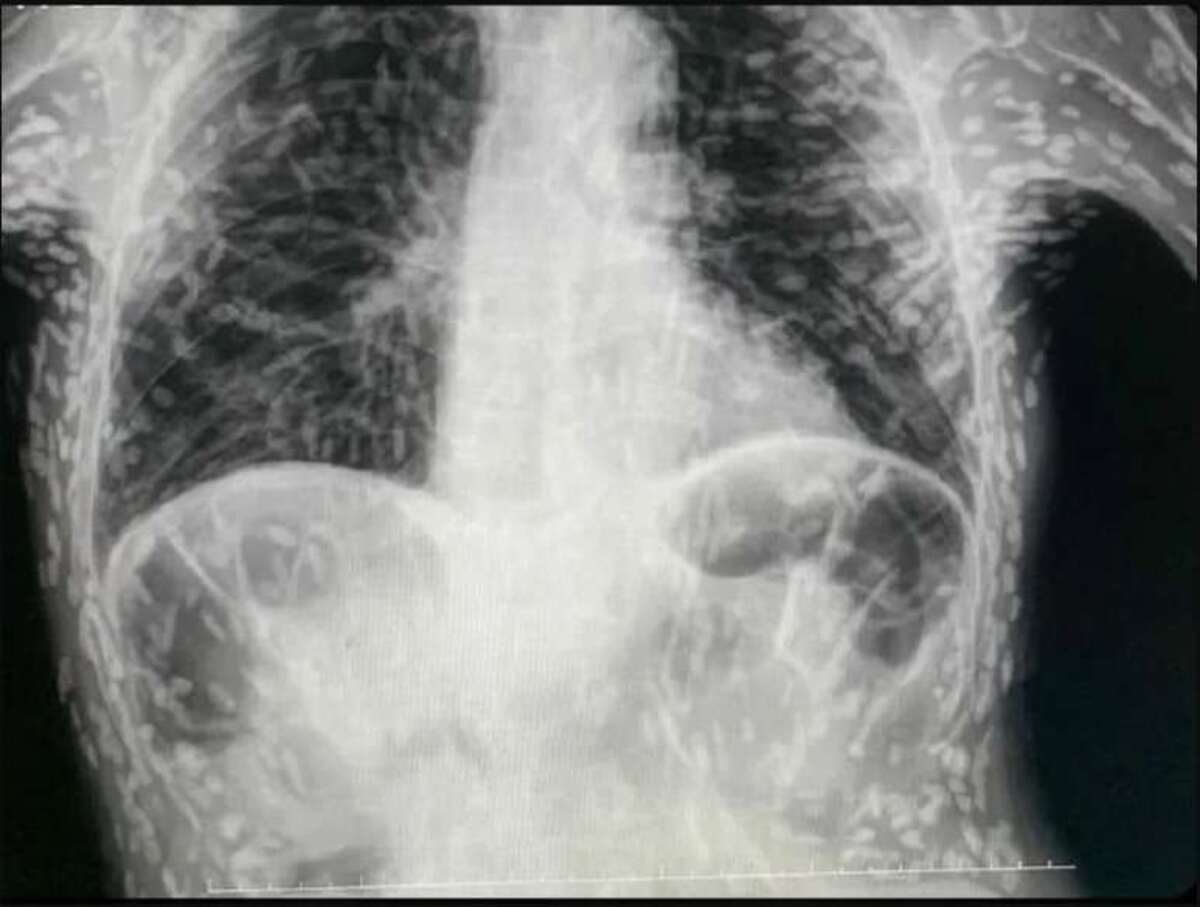  (crédito: Reprodução/Twitter vitorborin_)