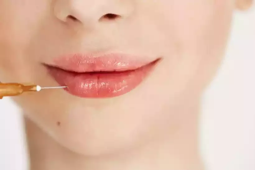 O preenchimento labial é feito com base em um estudo detalhado da face - (crédito: Freepik/Divulgação) O preenchimento labial é feito com base em um estudo detalhado da face - (crédito: Freepik/Divulgação)