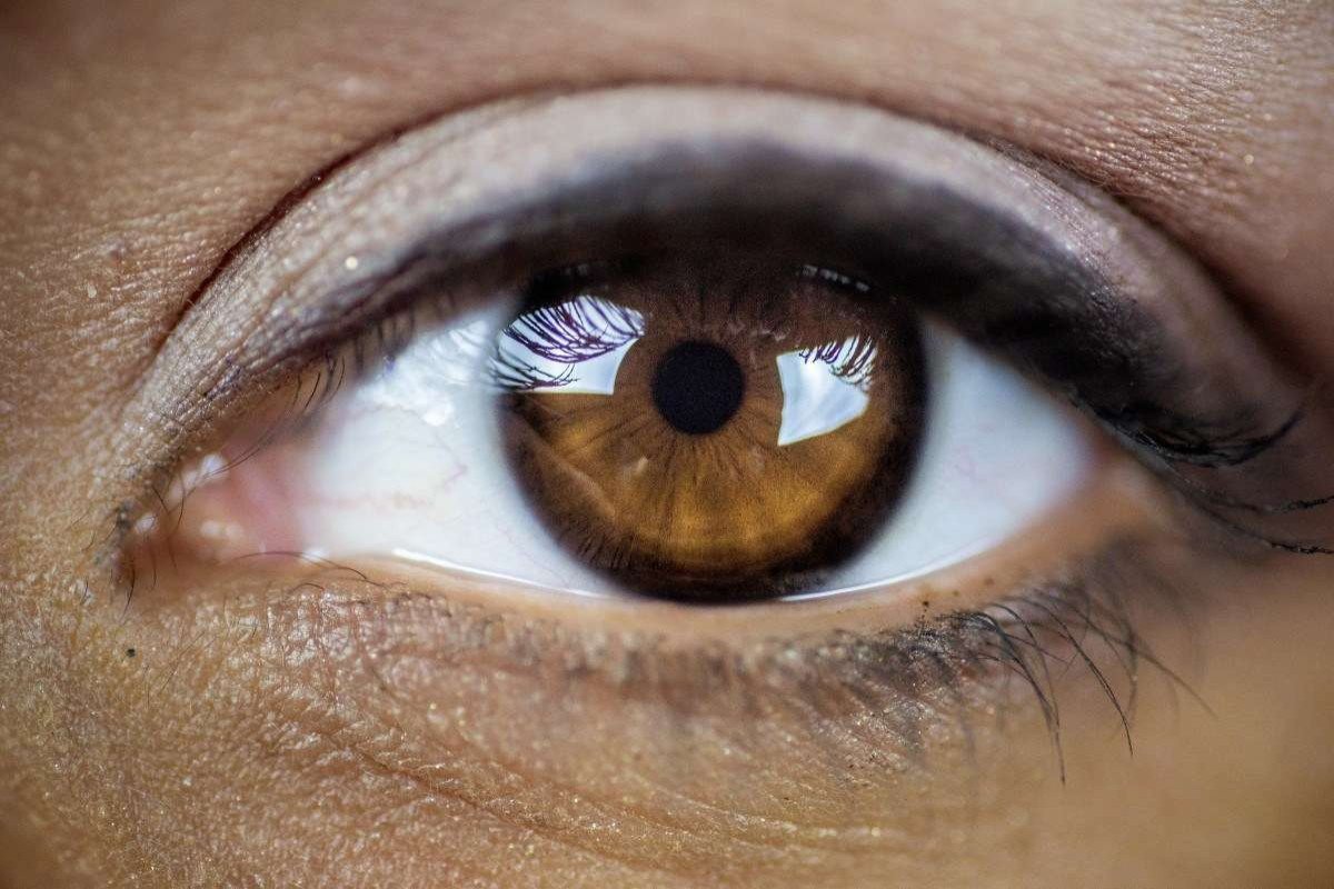 Maio Verde: especialista explica sobre os tratamentos e riscos do glaucoma