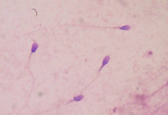 Wikimedia commons/Divulgação