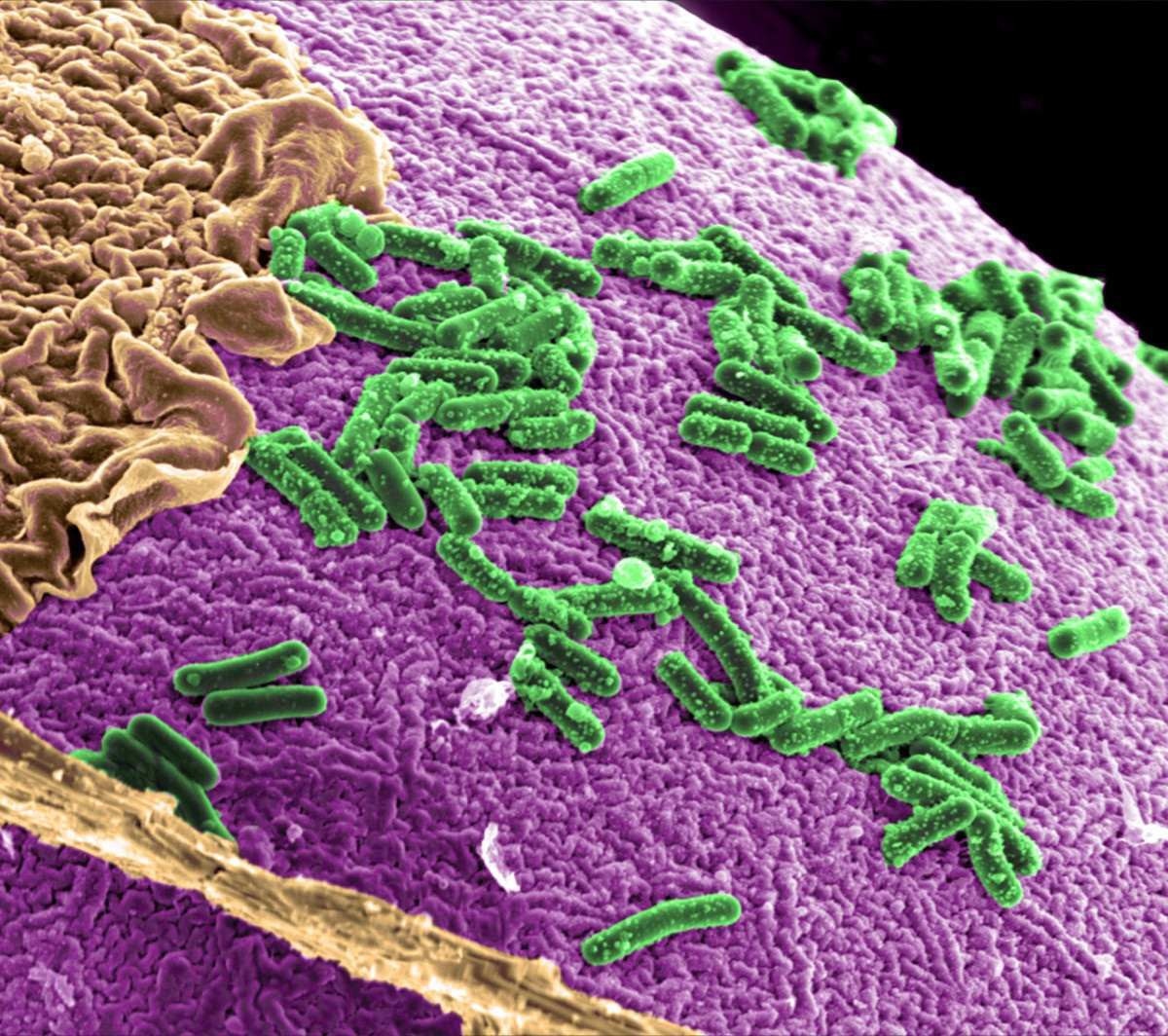 Flora intestinal desarmônica ameaça transplantados