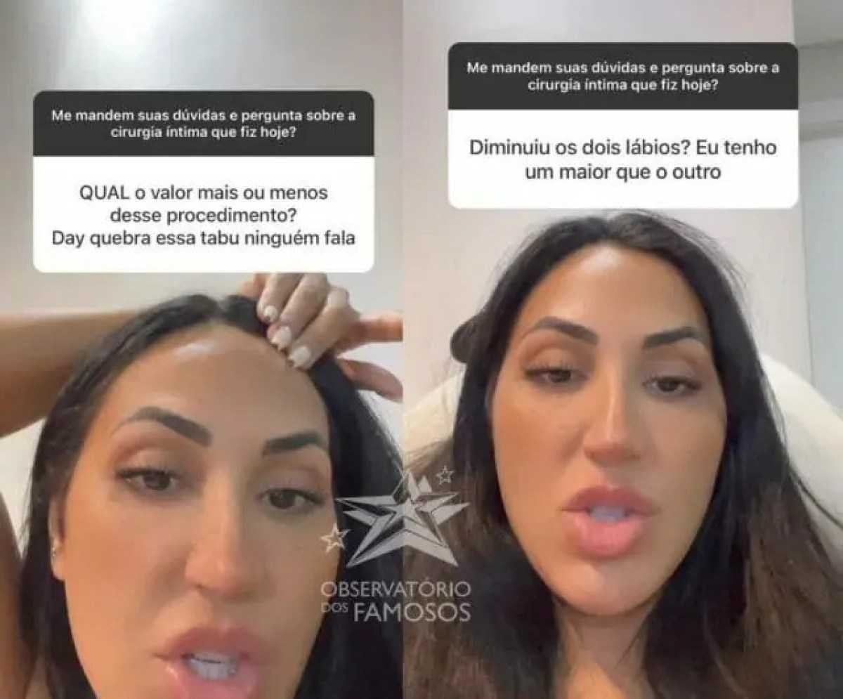 Saiba quanto a irmã de Deolane Bezerra gastou para fazer cirurgia íntima