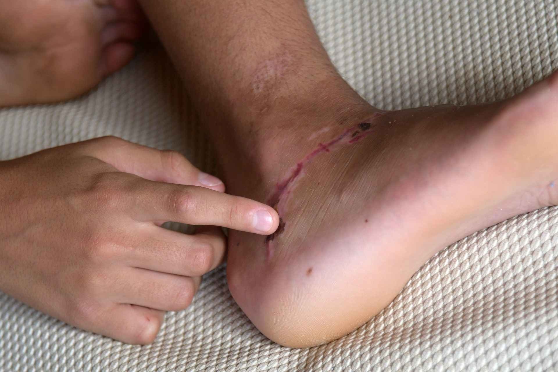 Garoto colocou pé em 