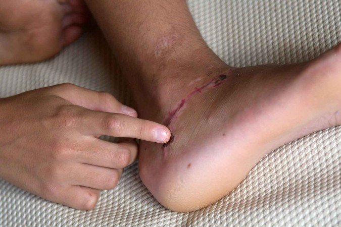  (crédito:  Ed Alves/CB/DA.Press)