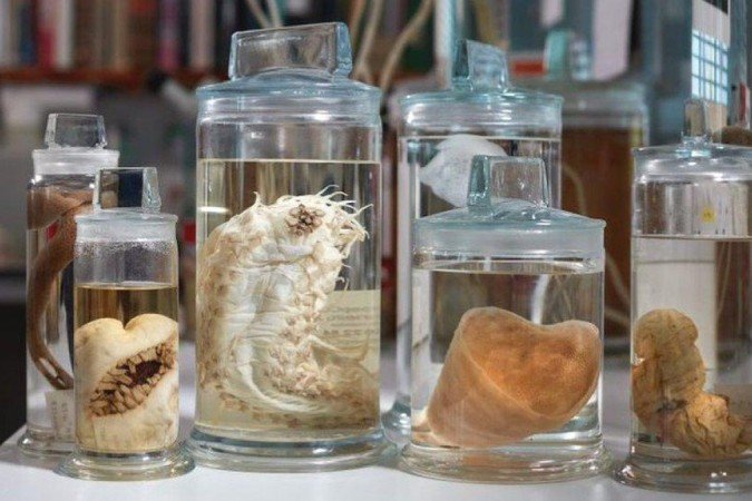 De anêmonas a vermes: várias criaturas estranhas foram recuperadas da Zona Clarion-Clipperton do Oceano Pacífico
- (crédito: Natural History Museum London) De anêmonas a vermes: várias criaturas estranhas foram recuperadas da Zona Clarion-Clipperton do Oceano Pacífico
- (crédito: Natural History Museum London)