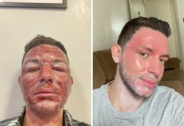 Reprodução: Instagram/ Joaocastroph