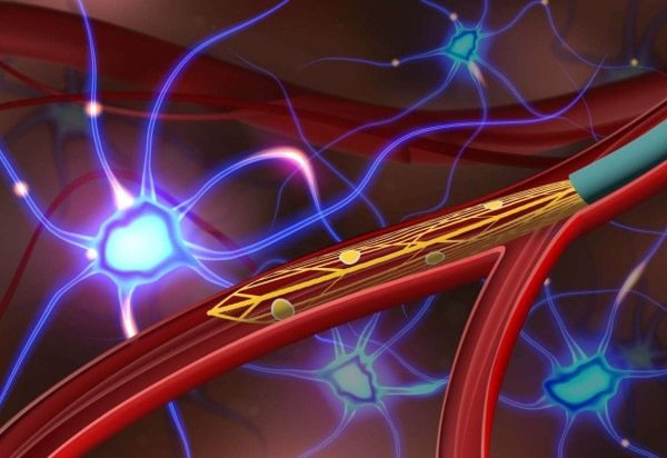 Anqi Zhang, Stanford University