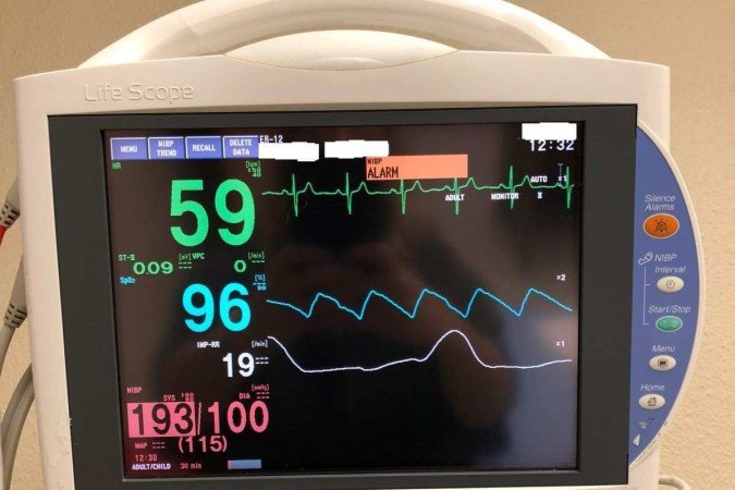 Monitor cardíaco em quarto de hospital mostrando frequência cardíaca e pressão arterial elevada. - (crédito: American Heart Association) Monitor cardíaco em quarto de hospital mostrando frequência cardíaca e pressão arterial elevada. - (crédito: American Heart Association)
