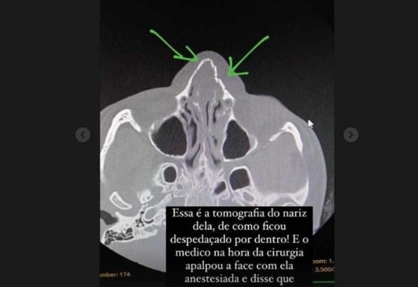 Reprodução/Instagram/@teca_bonatto