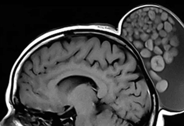 Reprodução/Radiology