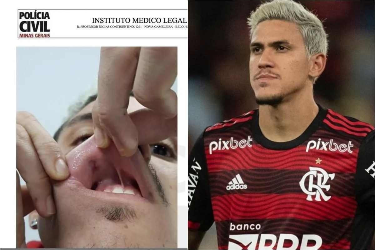 Hoje não, hoje não, hoje sim… os memes do empate do Botafogo com o Santos