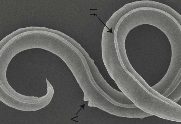 Reprodução/ PLOS GENETICS