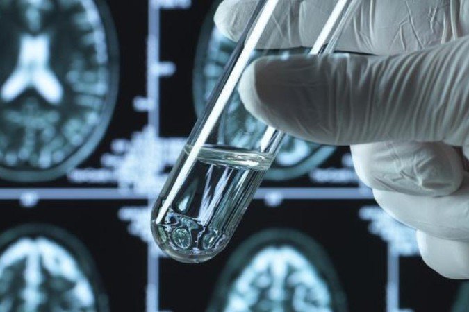 Novos remédios foram os primeiros a desacelerar progressão dos sintomas -  (crédito: Getty Images)