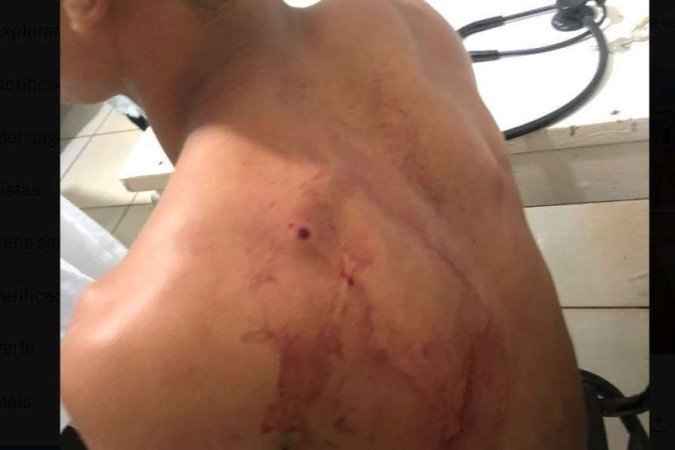 Indígena teria sido baleado por seguranças de empresa - (crédito: Redes sociais @Reginal91386546/ reprodução) Indígena teria sido baleado por seguranças de empresa - (crédito: Redes sociais @Reginal91386546/ reprodução)
