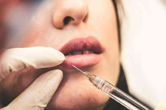 Busca excessiva pela aparência perfeita levou muitas pessoas a optarem por preenchimentos faciais em excesso, resultando em um efeito artificial ou desproporcional - (crédito: Sam Moghadam Khamseh/Unsplash) Busca excessiva pela aparência perfeita levou muitas pessoas a optarem por preenchimentos faciais em excesso, resultando em um efeito artificial ou desproporcional - (crédito: Sam Moghadam Khamseh/Unsplash)