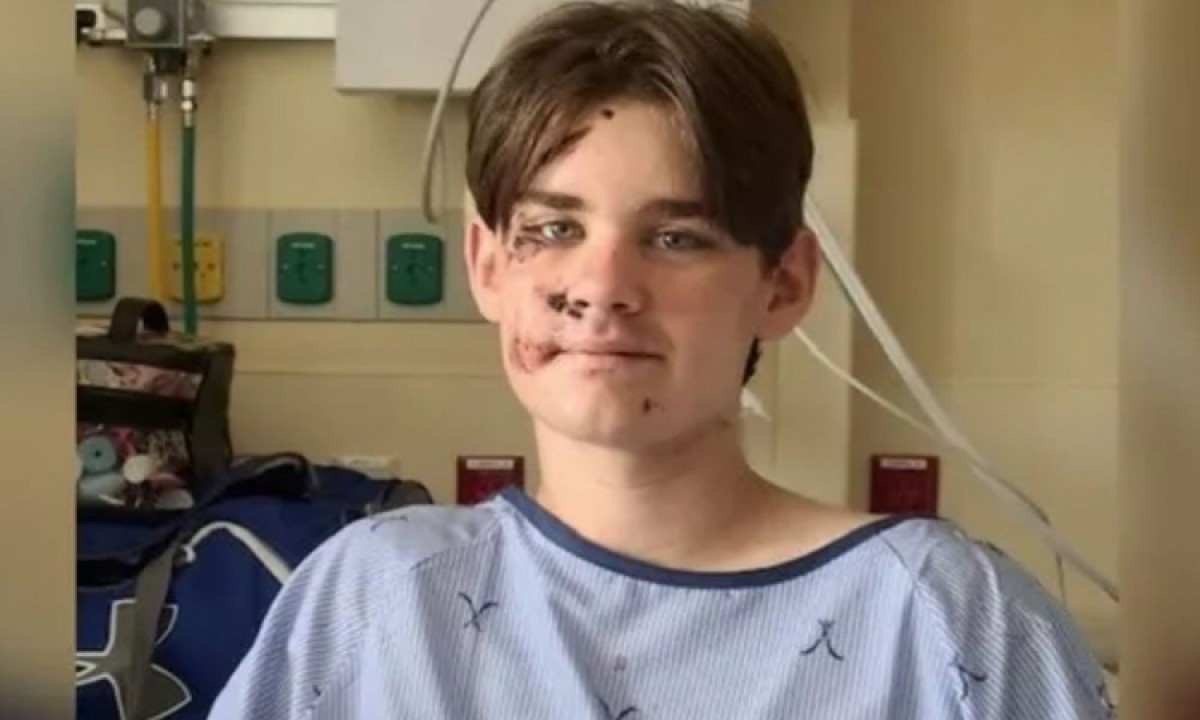 Adolescente de 13 anos sobrevive após cair de penhasco de 30 metros