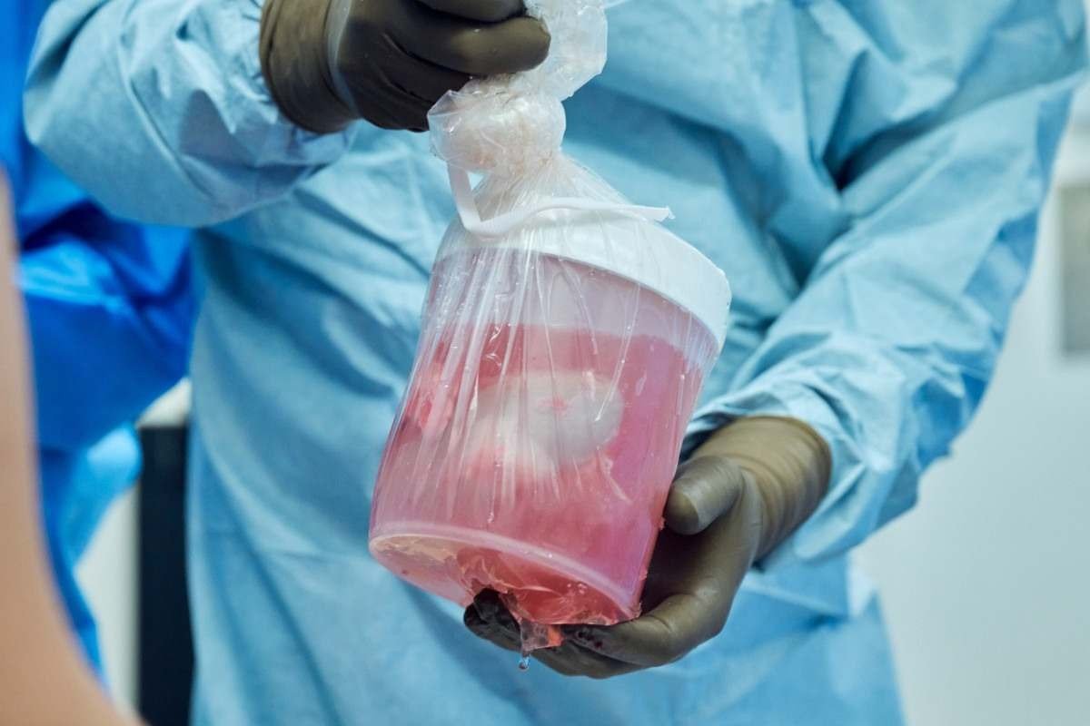Rins de um porco usados em um transplante da Universidade de Nova York. Os órgãos foram transplantados para um cadáver humano, mantido por aparelhos 