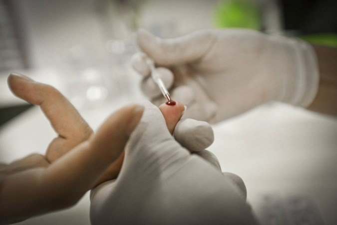 A sífilis apresenta-se de maneira assintomática ou com sintomas imperceptíveis, daí a importância de prevenir e realizar testagens periódicas - (crédito: Reprodução: Breno Esaki/Agência Saúde-DF.) A sífilis apresenta-se de maneira assintomática ou com sintomas imperceptíveis, daí a importância de prevenir e realizar testagens periódicas - (crédito: Reprodução: Breno Esaki/Agência Saúde-DF.)