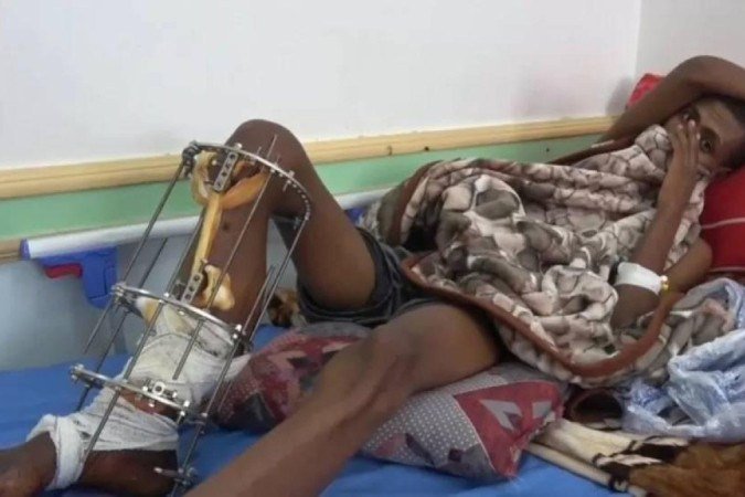 Imigrantes etíopes dizem que foram baleados quando tentavam cruzar do Iêmen para a Arábia Saudita - (crédito: BBC) Imigrantes etíopes dizem que foram baleados quando tentavam cruzar do Iêmen para a Arábia Saudita - (crédito: BBC)