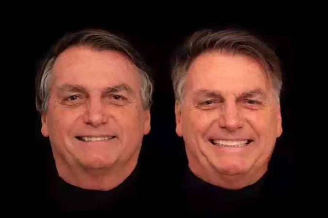 O procedimento realizado por Bolsonaro foi feito no consultório do dentista Rildo Lasmar, em Goiânia. - (crédito: Reprodução/Instagram/@rildolasmar) O procedimento realizado por Bolsonaro foi feito no consultório do dentista Rildo Lasmar, em Goiânia. - (crédito: Reprodução/Instagram/@rildolasmar)