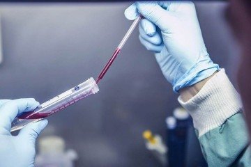 O teste avalia a quantidade de hormônios e a partir daí, é possível escolher a melhor forma de  prevenção para o tumor de mama -  (crédito: Mayeta Clark, Walter and Eliza Hall Inst., Australia)