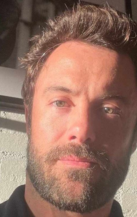 O ator Kayky Brito foi atropelado no Rio de Janeiro e está em estado grave -  (crédito: Reprodução/Instagram)