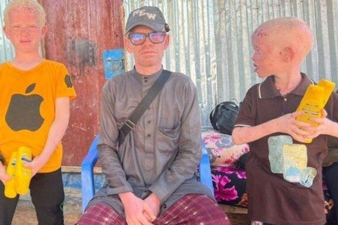 O chefe da associação de albinos da Somália, Mohamed Abukar Abdiqadir, com os seus filhos - (crédito: BBC) O chefe da associação de albinos da Somália, Mohamed Abukar Abdiqadir, com os seus filhos - (crédito: BBC)