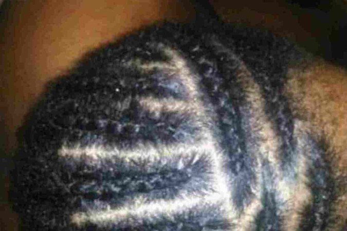 &Eacute;ricka Braids tamb&eacute;m desenvolveu uma t&eacute;cnica para ajudar pessoas com calv&iacute;cie