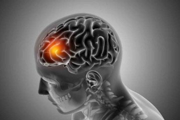 Mês de setembro é marcado pela conscientização do aneurisma cerebral -  (crédito: Reprodução/ Freepik/ Kjpargeter)