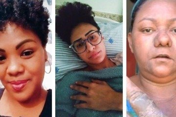 Kelli, Shely e Liliane relatam sofrer de efeitos colaterais pela inserção do Essure. -  (crédito: Arquivo pessoal)