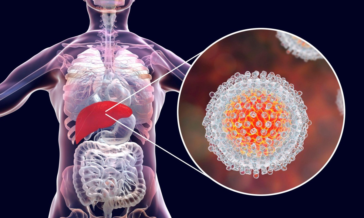 Hepatite C e tatuagens: quais são os riscos e como evitá-los?