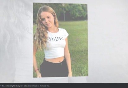 A morte de uma jovem de 18 anos em decorrência de infecções provocadas pela retirada dos dentes do siso, no interior de São Paulo, causou perplexidade. O FLIPAR mostrou e republica para quem não viu. - (crédito: REPRODUÇÃO DE VÍDEO G1)