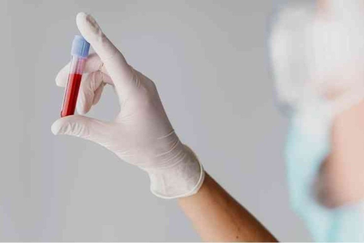 Hemofilia A: paciente na Alemanha é primeiro a ser tratado na Europa 