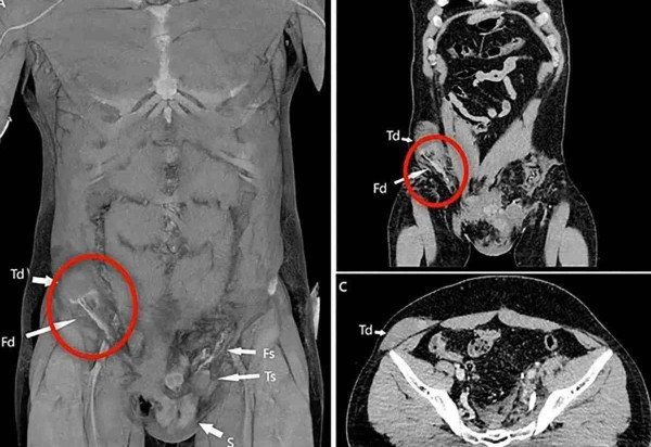 Reprodução/BMJ Journals