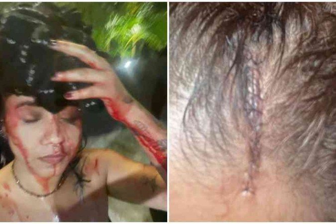 Jovem defende amiga de assédio e é agredida com garrafa em boate - (crédito: EM Gerais) Jovem defende amiga de assédio e é agredida com garrafa em boate - (crédito: EM Gerais)
