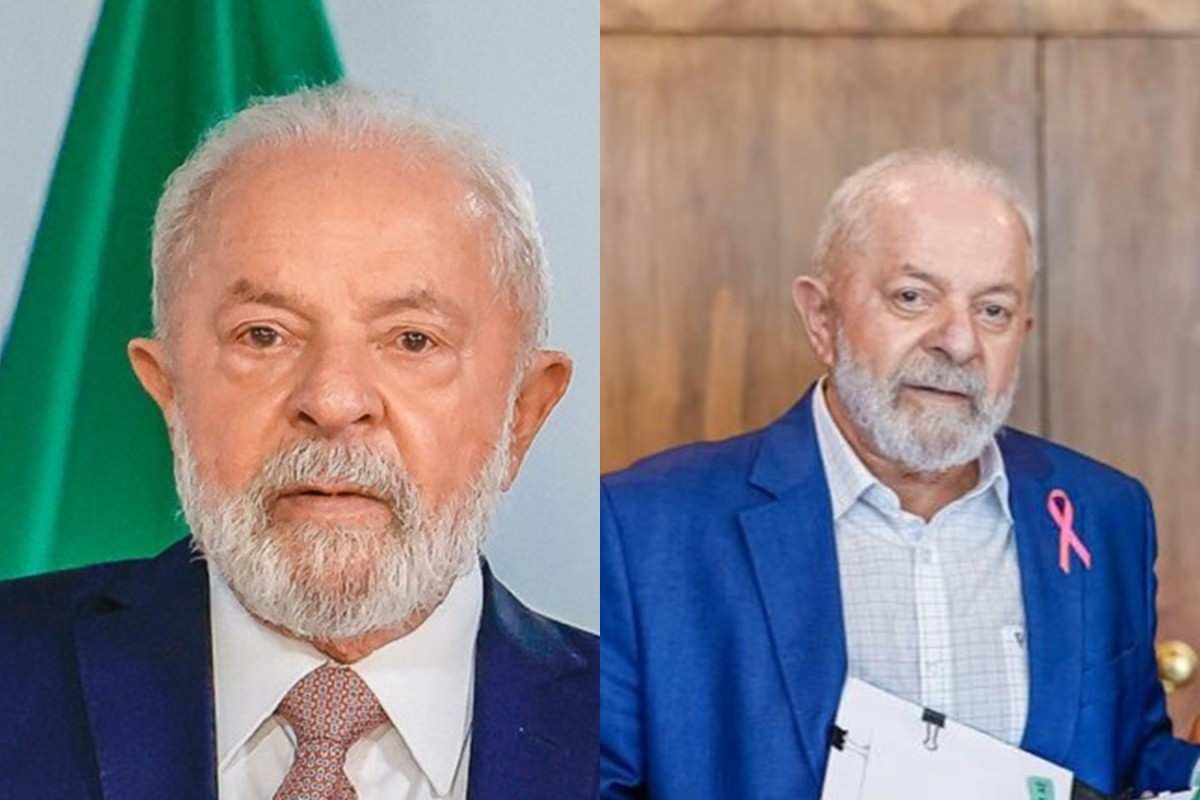 Veja o antes e depois de Lula após cirurgia plástica nas pálpebras