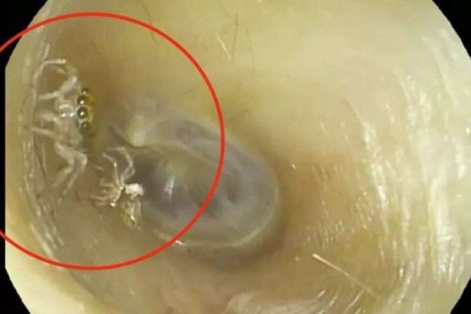 Mulher procura clínica após Mulher procura clínica após