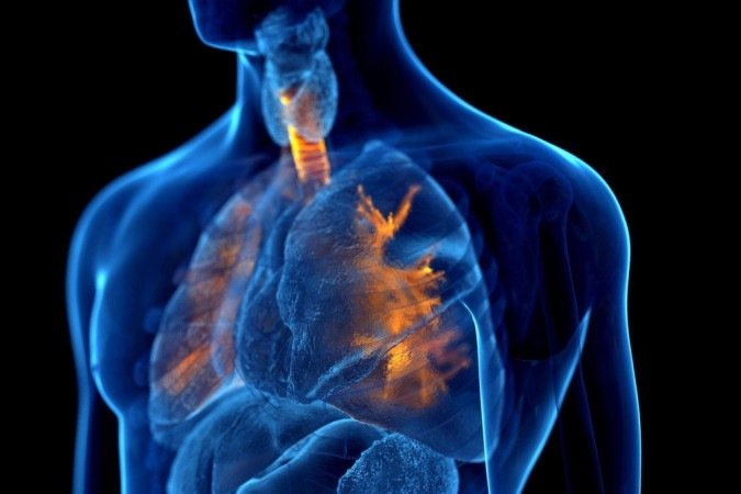 Em uma pessoa asmática, os brônquios são anormalmente sensíveis a certos fatores ambientais. - (crédito: Getty Images) Em uma pessoa asmática, os brônquios são anormalmente sensíveis a certos fatores ambientais. - (crédito: Getty Images)