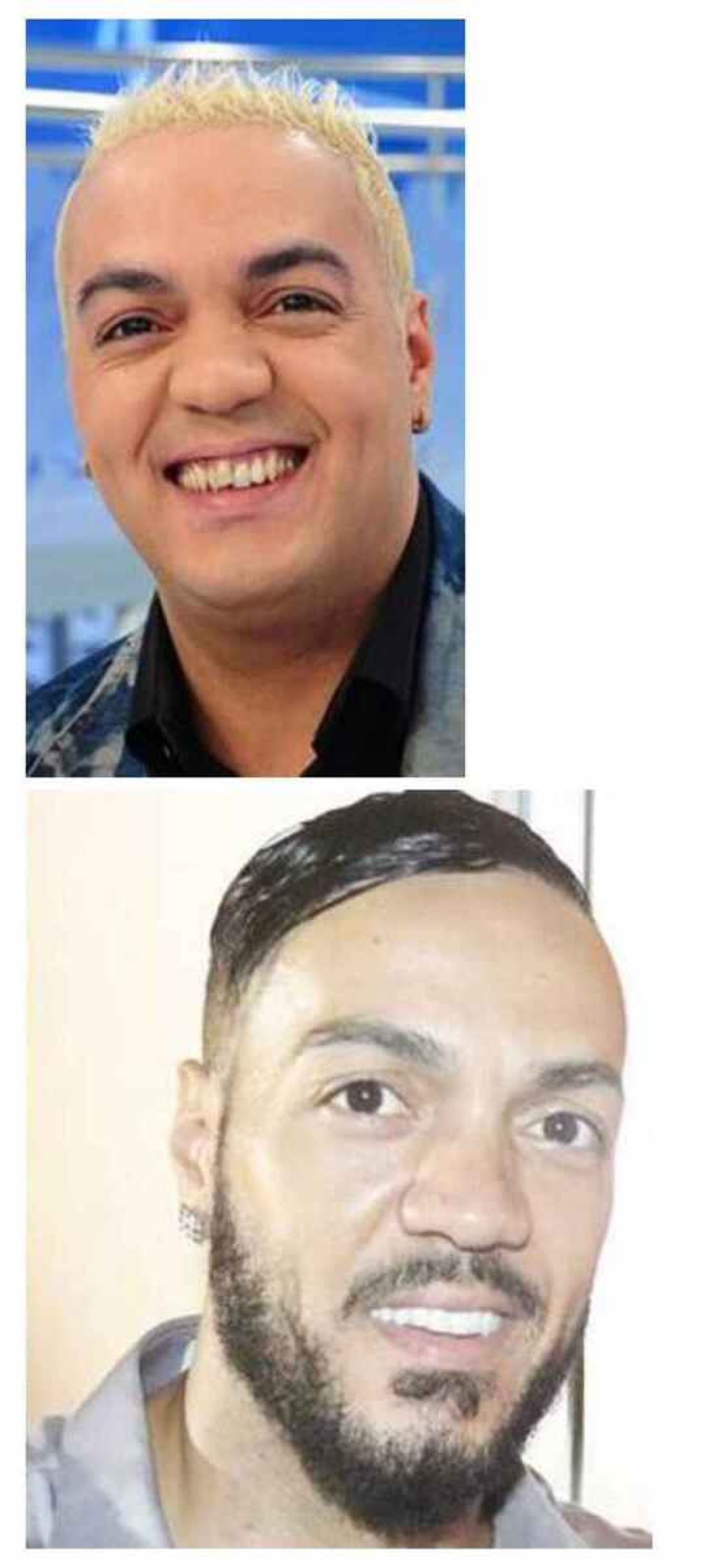 O antes e depois do sorriso do cantor Belo